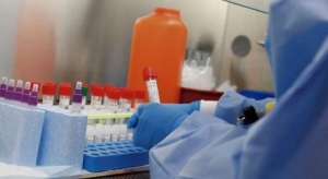 SITUACIÓN EPIDEMIOLÓGICA ACTUAL.