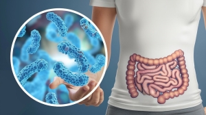 TRIQUINOSIS - CONTROLES SANITARIOS Y BROMATOLÓGICOS
